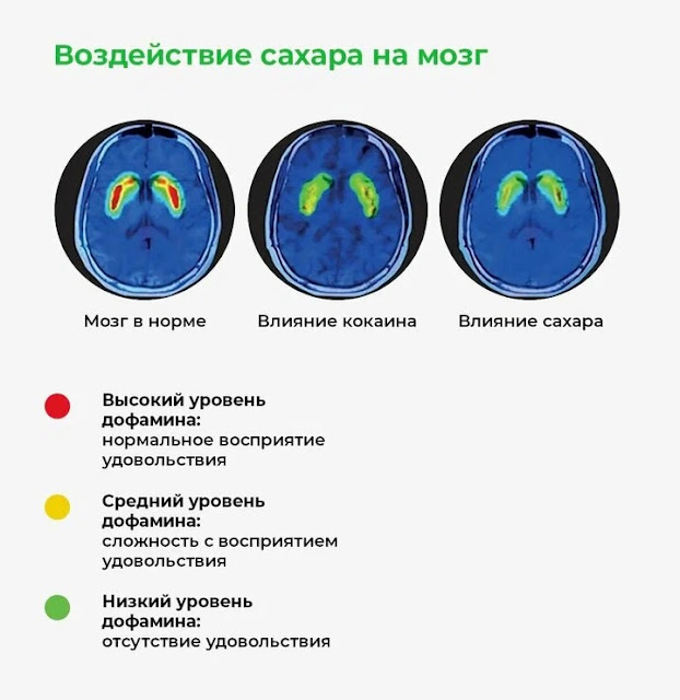 Як цукор вбиває лібідо